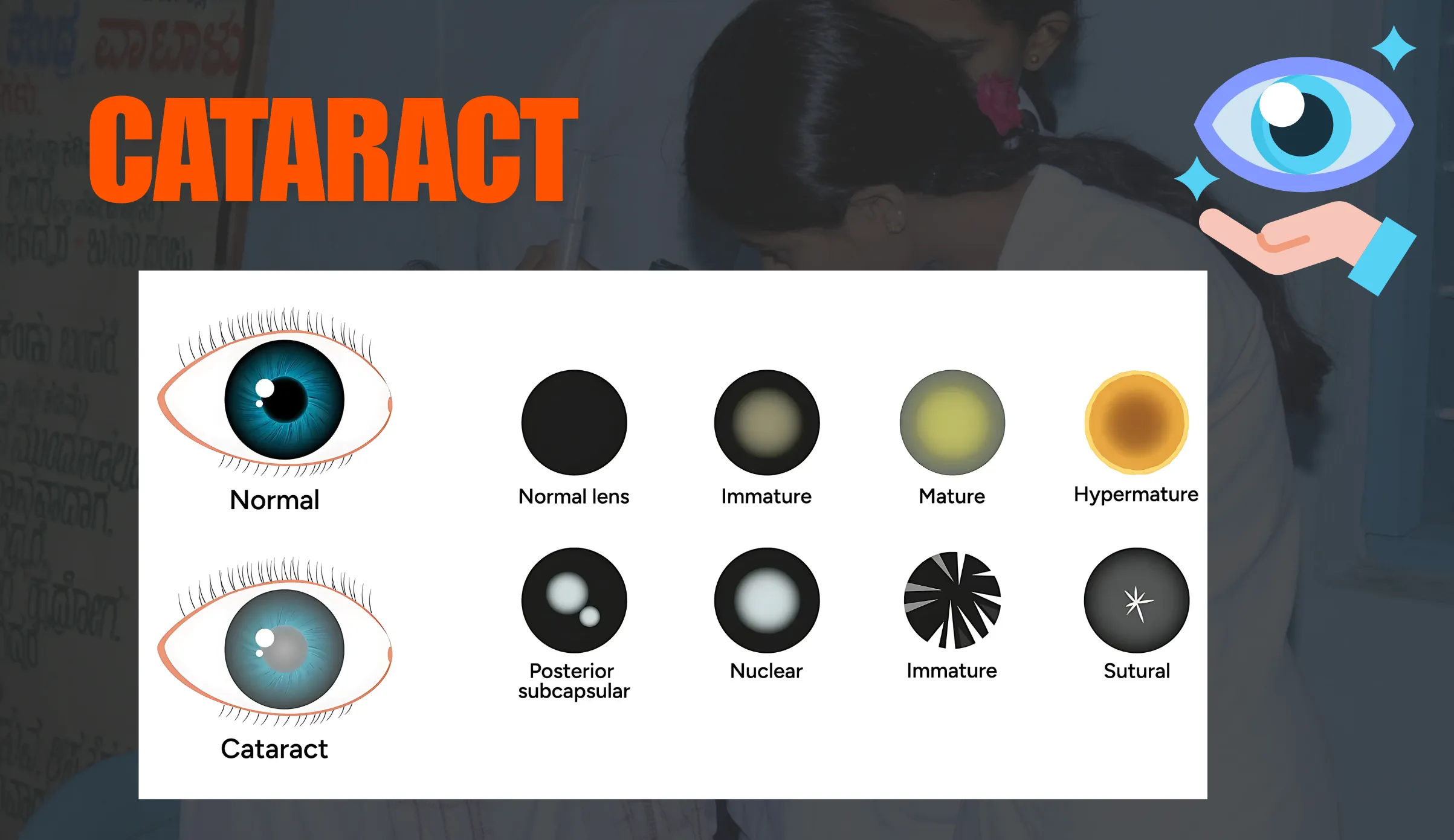 Cataract-Surgery